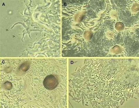 Myxobacteria - Alchetron, The Free Social Encyclopedia