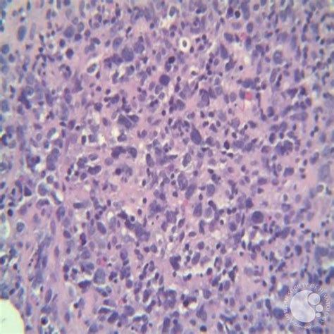 Figure 2. Liver biopsy