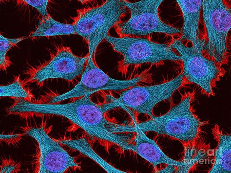 Hela Cells, Light Micrograph Photograph by National Institutes Of Health - Fine Art America