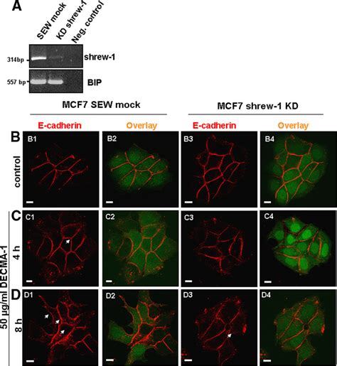 Direct disassembly of adherens junctions by E-cadherin... | Download Scientific Diagram