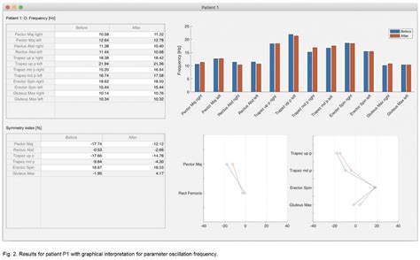 Investigation of Muscle Imbalance: a feasibility study - Myoton