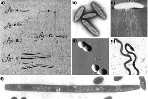 Cazadores de Microbios: Sebastián Cevallos M. timeline | Timetoast ...