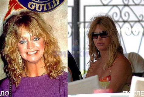 Before and after pics: Goldie Hawn before and after pics