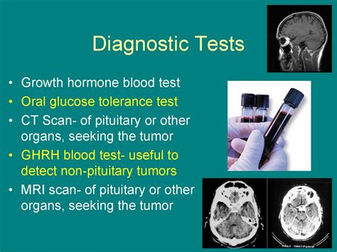 Acromegaly. Description - презентация онлайн