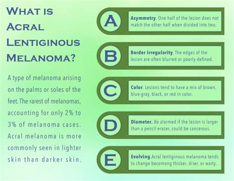 What is Acral Lentiginous Melanoma?