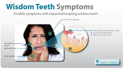 The Best How Much To Remove Wisdom Teeth In South Africa Ideas