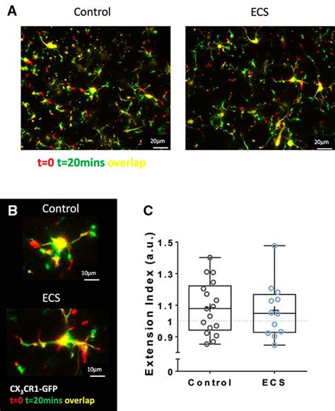 Electroconvulsive Shock Enhances Responsive Motility and Purinergic Currents in Microglia in the ...