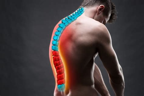 What Causes a Stiff Back: 7 Common Stiff Back Causes