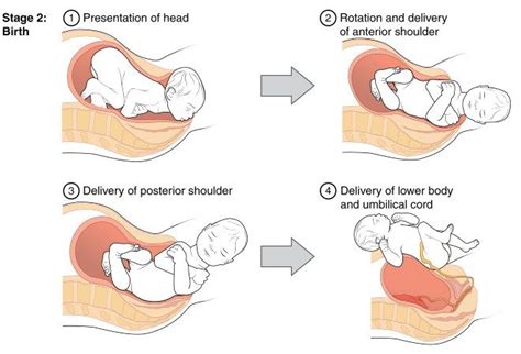 The Four Stages of Labor and How to Deal With Them Best | Stages of labor, Midwifery, Birth partner