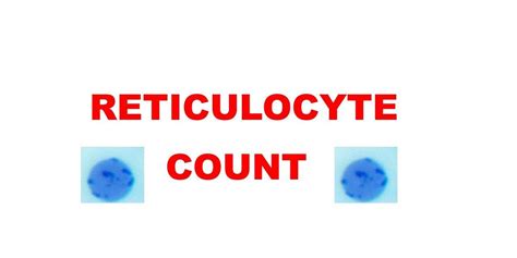 RETICULOCYTE COUNT - Pathology Made Simple