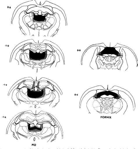 Figure 1 from The effects of lesions to the fornix and dorsomedial ...