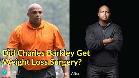 Did Charles Barkley Get Weight Loss Surgery? - Mexico Bariatric Center®