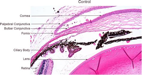 The fornix joins the bulbar conjunctiva lining the globe with the... | Download Scientific Diagram