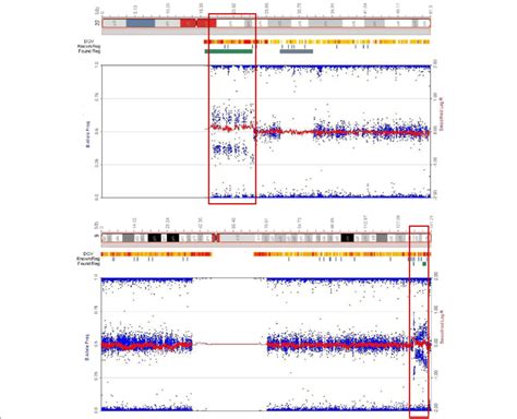 SNP microarray analysis of bone marrow sample of patient at diagnosis.... | Download Scientific ...