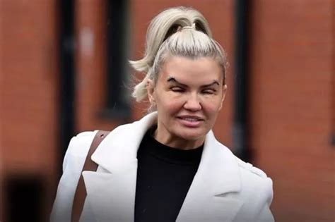 Kerry Katona barely able to see as OnlyFans star is pictured after eye ...