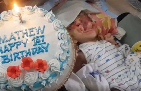 Baby born without face defies all odds to celebrate his first birthday - Best World News