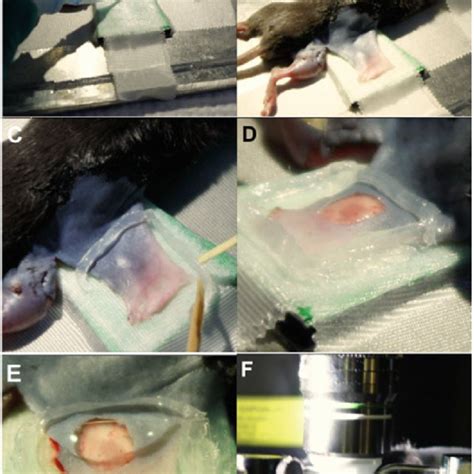 Sequential steps of the surgical procedure to expose the lymph node for... | Download High ...