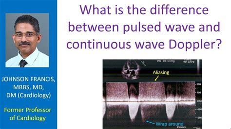 What is the difference between pulsed wave and continuous wave Doppler ...