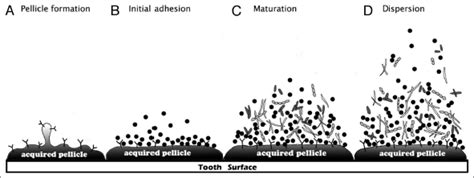 Dental Plaque Formation Stages