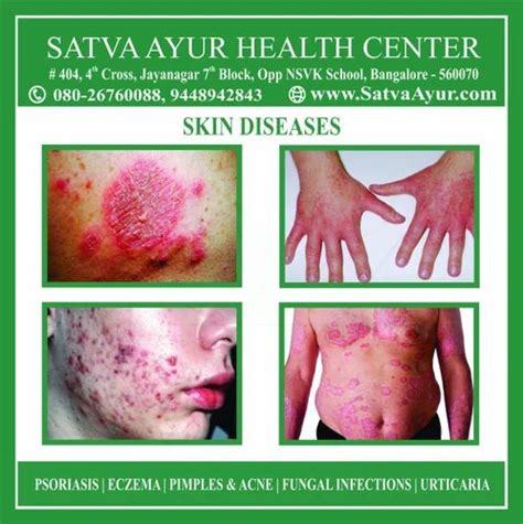 Skin Diseases Psoriasis Eczema And Fungal Infections at best price in Bengaluru | ID: 20374938655