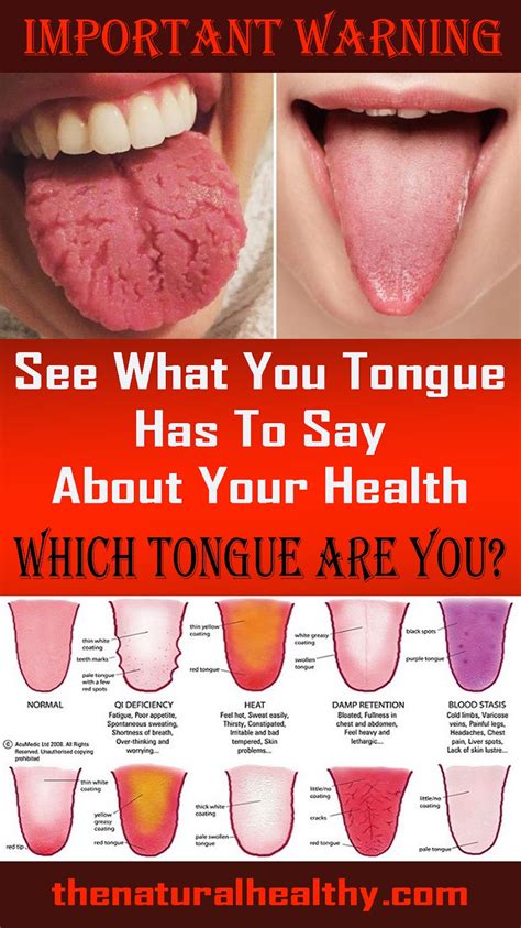 WHAT YOUR TONGUE CAN TELL YOU ABOUT YOUR HEALTH - Andhara Beauty