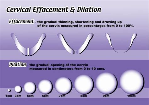 Cervical Dilation Finger Chart