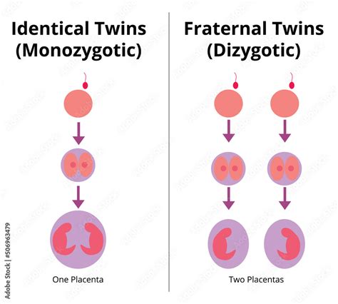 Difference between identical and fraternal twins. Monozygotic and dizygotic twins. Vector ...