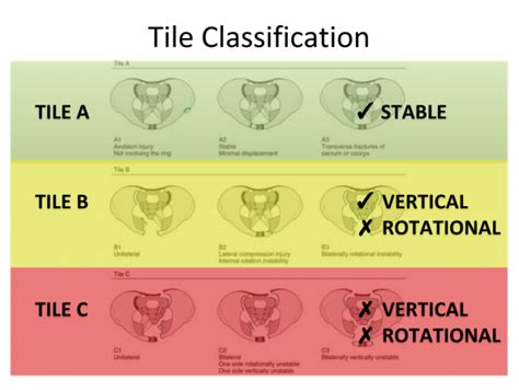 Opening the Book: Pelvic Trauma in the ED - EMOttawa Blog