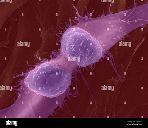 Muscle myoblast (primitive embryonic muscle cell) dividing, coloured scanning electron ...