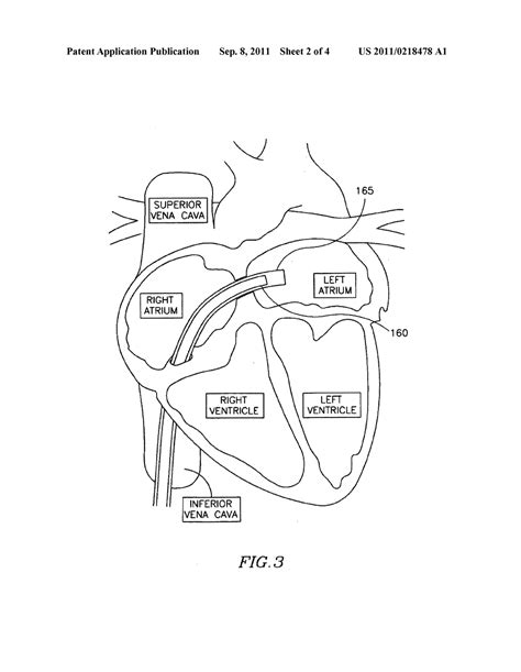 Free Circulatory System For Kids Coloring Pages, Download Free Circulatory System For Kids ...