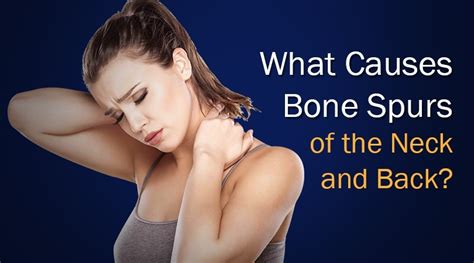 What Causes Bone Spurs of the Back and Neck?