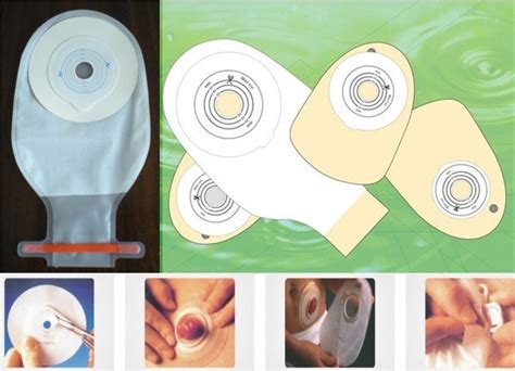 Stoma Bag - China Stoma Care and Ostomy Care