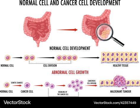 Cancer Cells Vs Normal Cells Chart