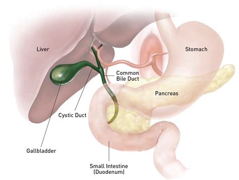 Laparoscopic Cholecystectomy