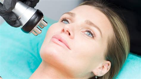 What Is Radio Frequency Skin Tightening? – Memoria Y Dignidad