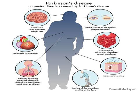 Frontotemporal Dementia