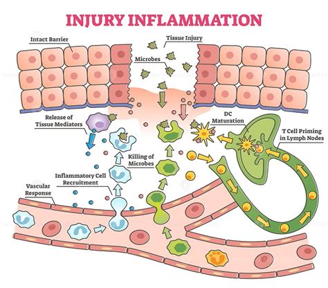 Injury inflammation as body response process in educational outline diagram - VectorMine