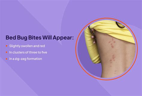 How to Know If You are Bitten by Bed Bugs?