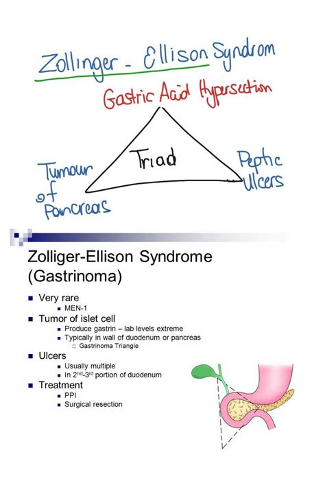 Zollinger-ellison syndrome... MEN 1 | Medical knowledge, Nursing study, Medical education