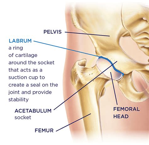 What is Hip Arthroscopy? Procedure & Recovery | OrthoNebraska