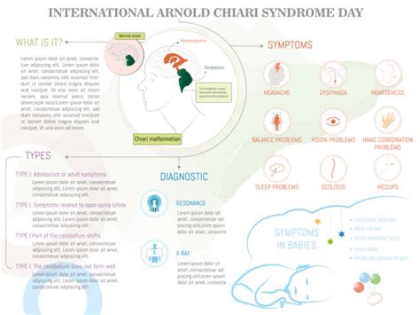 10+ Cerebellar Tonsils Illustrations, Royalty-Free Vector Graphics & Clip Art - iStock