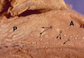 Oral Histology Digital Lab: Mucosa: Circumvallate Papillae (Image 23)