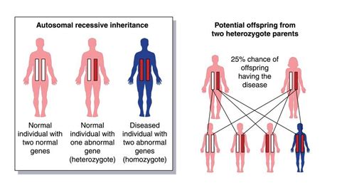 Recessive Gene Definition | Hot Sex Picture