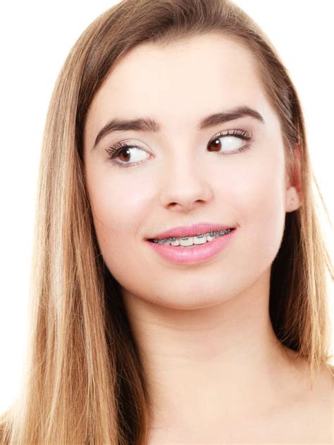 Woman Showing Her Teeth with Braces Stock Image - Image of stomatology ...