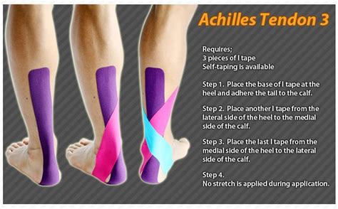 1000+ images about Kinesiology Tape: Ares on Pinterest | Knee pain ...