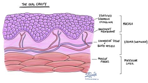 Squamous dysplasia of the oral cavity | MyPathologyReport.ca