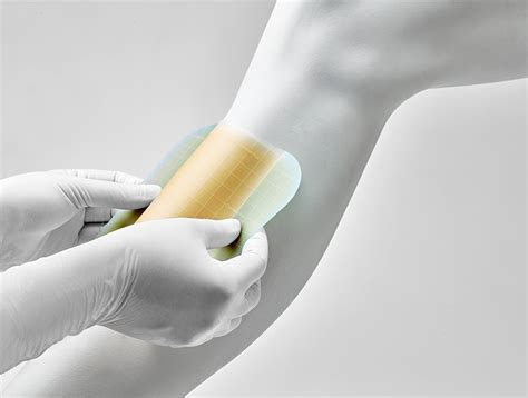 How do hydrocolloid dressings aid the wound healing process?