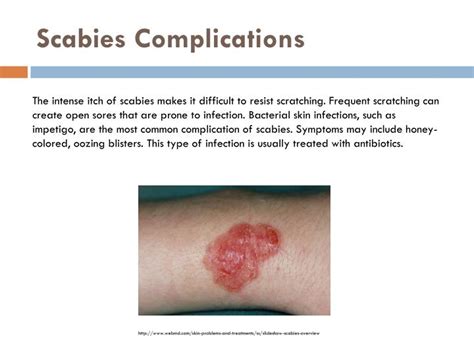 Stages Of Healing Scabies