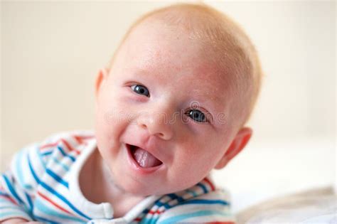 Allergies, Atopic Dermatitis on the Face Stock Photo - Image of atopy, baby: 116316998