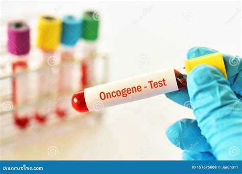 Blood Sample for Oncogene Test Stock Photo - Image of health ...